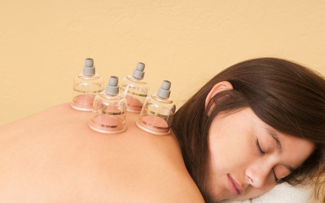 ProSelect Cupping Therapy