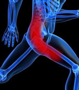 Self care and massage for Piriformis Syndrome